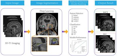 Automatic detection of mild cognitive impairment based on deep learning and radiomics of MR imaging